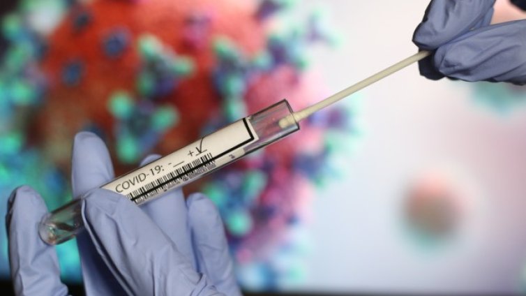 Eдна трета от починалите с COVID за денонощието без други болести