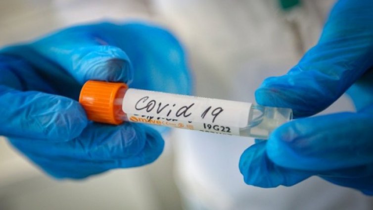 СЗО отчете спад с 10% на новите случаи на COVID-19 за седмица