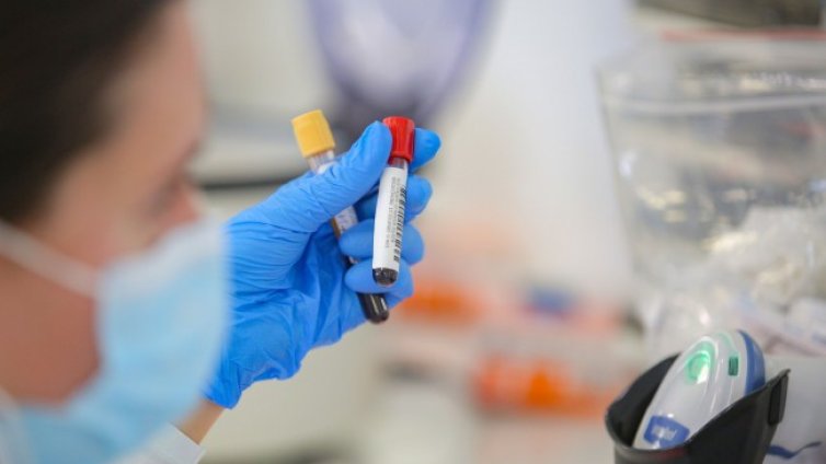 Мъж на 27 г. със заболявания е сред жертвите на Covid-19