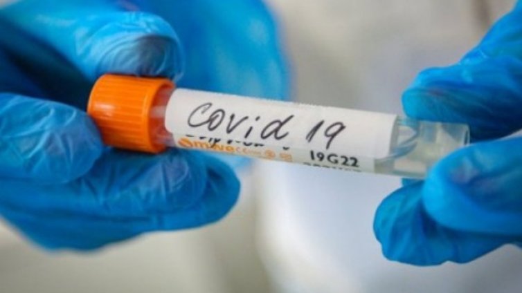 Учен разкри кой е най-опасният период при COVID-19