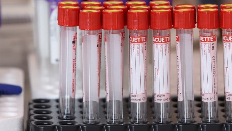 28 са новите случаи с Ковид, починали са двама