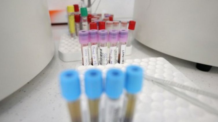 Петима души са загубили битката с COVID-19 за денонощието