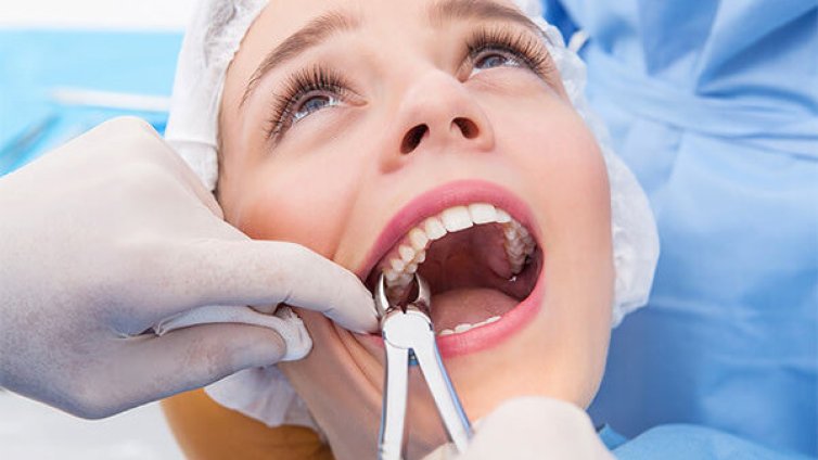 Затвор за дентални лекари, извадили 11 здрави зъба на пациентка