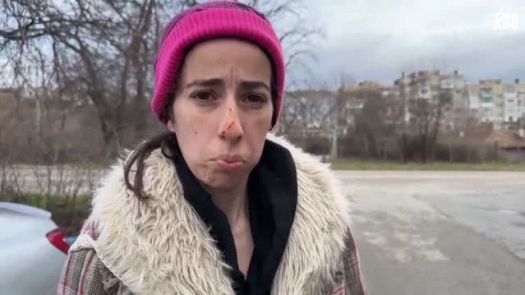 Жена е с множество ухапвания след нападение от овчарка в Казанлък