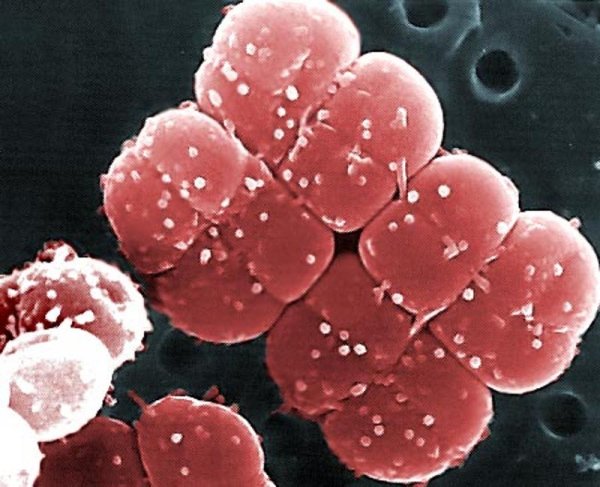 Deinococcus radiodurans. Снимка: scifun.ed.ac.uk
