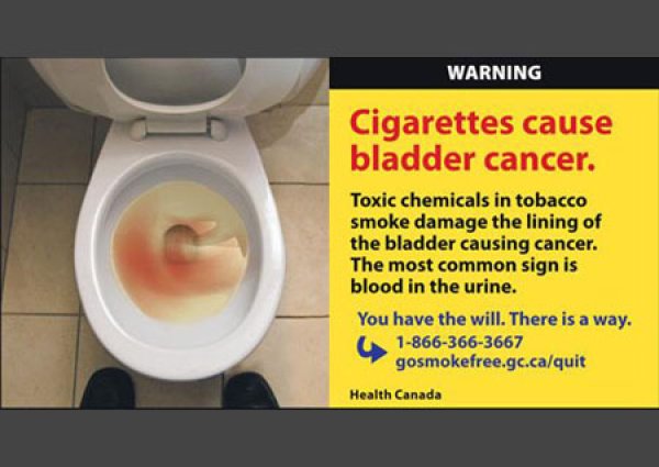 Цигарите предизвикват рак на пикочния мехур. Токсичните вещества от цигарения дим разрушават лигавицата на пикочния мехур, предизвиквайки рак. Най-честият му признак е кръв в урината.
Изображение: hc-sc.gc.ca