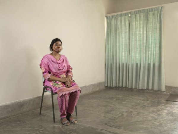 Жена от Бангладеш, пострадала след нападение с киселина, позира пред обектива. Снимка: Ken Hermann