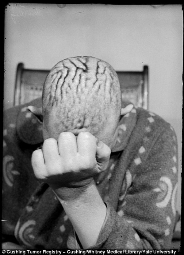 Снимка: Yale University