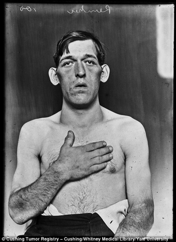 Снимка: Yale University