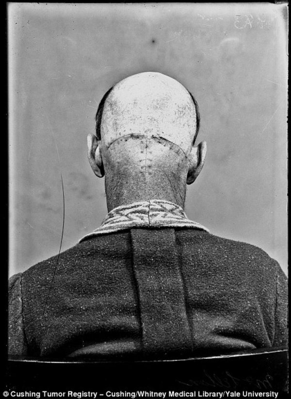 Снимка: Yale University