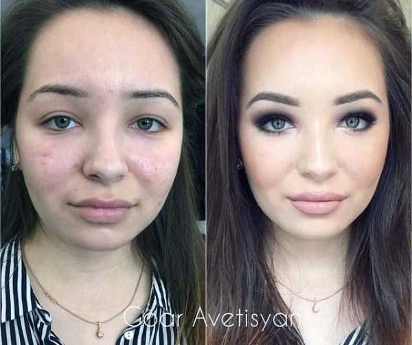 Снимка: Гоар Аветисян