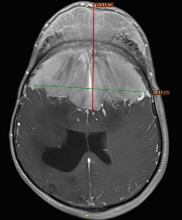 Снимка: УМБАЛ "Св. Иван Рилски"